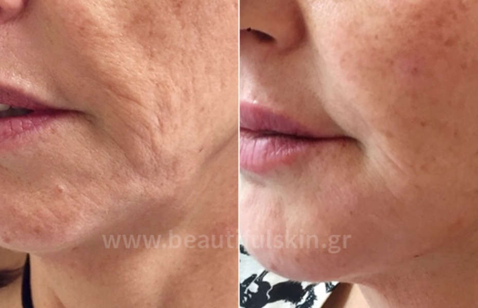 Untitled design 13 2