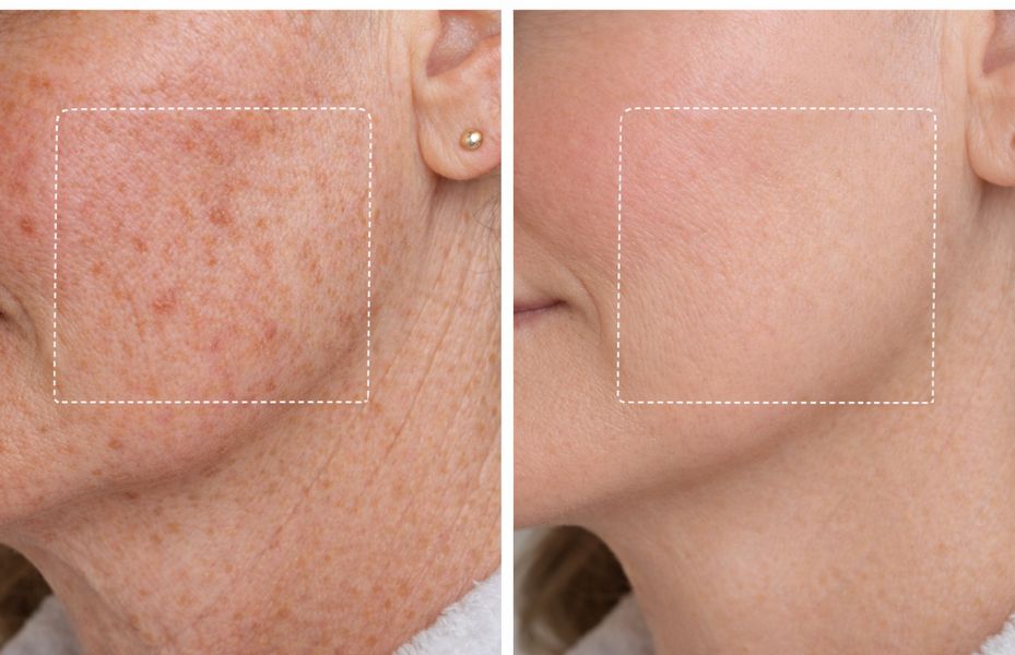 Untitled design 13 4