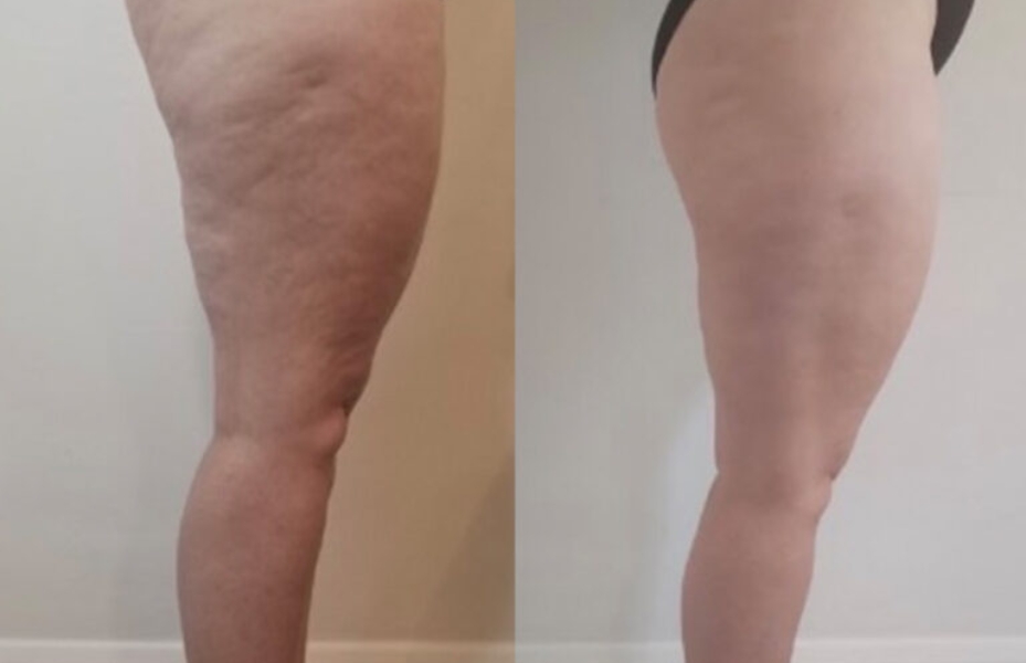 Untitled design 15 2