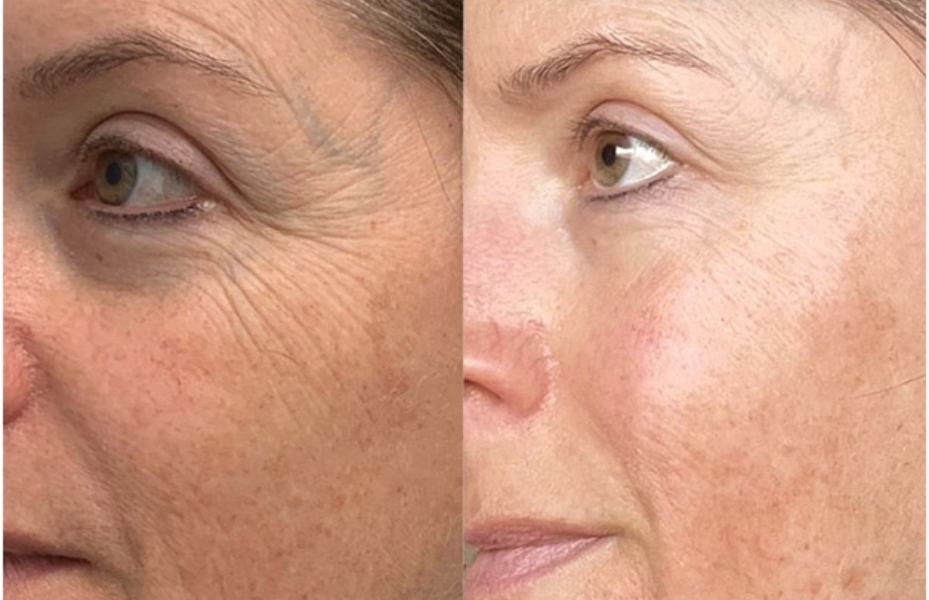 Untitled design 2026 01 06T165121.154