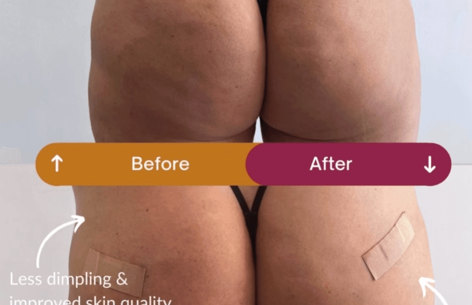 Untitled design 2026 01 06T171231.763