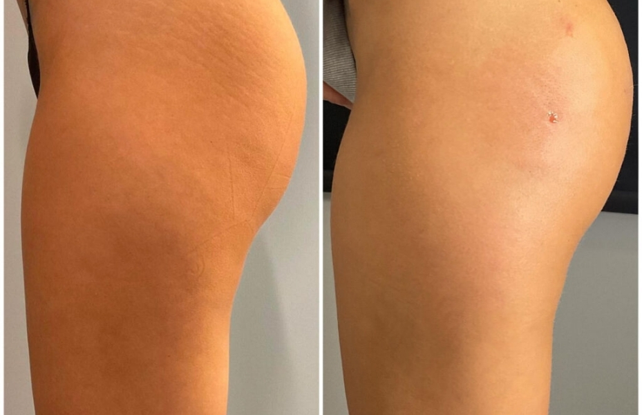 Untitled design 2026 01 06T171332.422