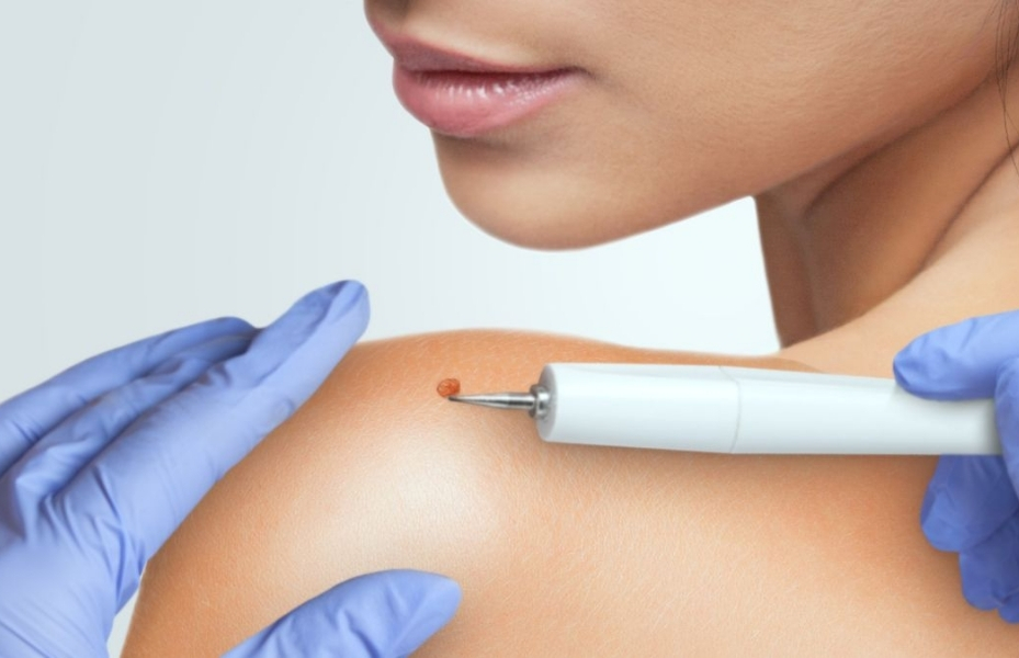 Untitled design 2026 01 06T175121.585