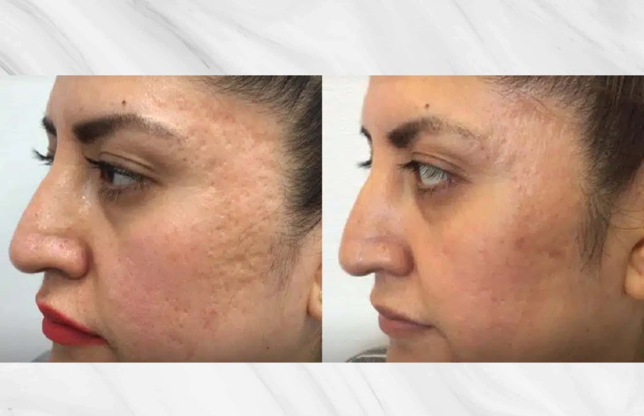 Untitled design 2026 01 07T110020.097