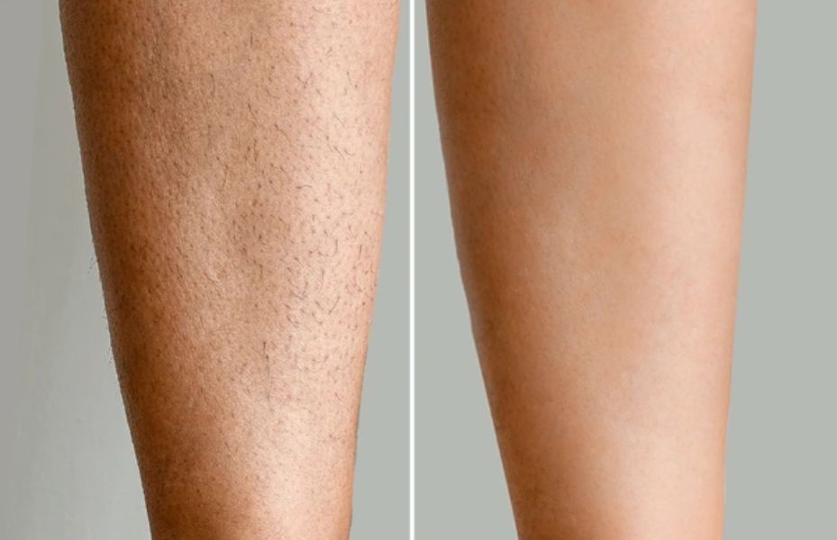 Untitled design 10 1